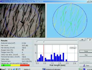 molemax-skin-imaging-software