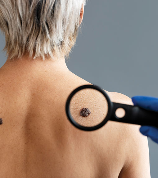 Assessment of melanoma thickness based on dermoscopy images: an open, web-based, international, diagnostic study