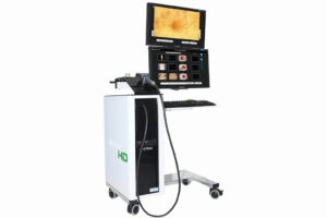MoleMax HD PRO digital skin imaging system for early melanoma detection