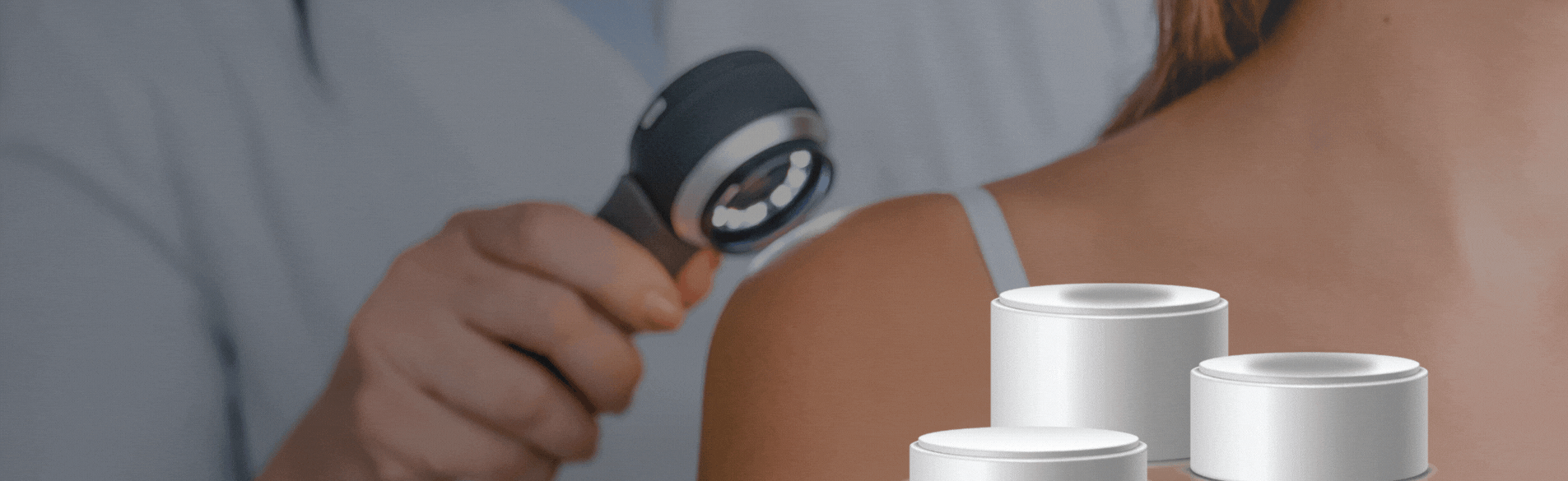 Mobile Dermatoscope Type in Patient-Performed Teledermoscopy