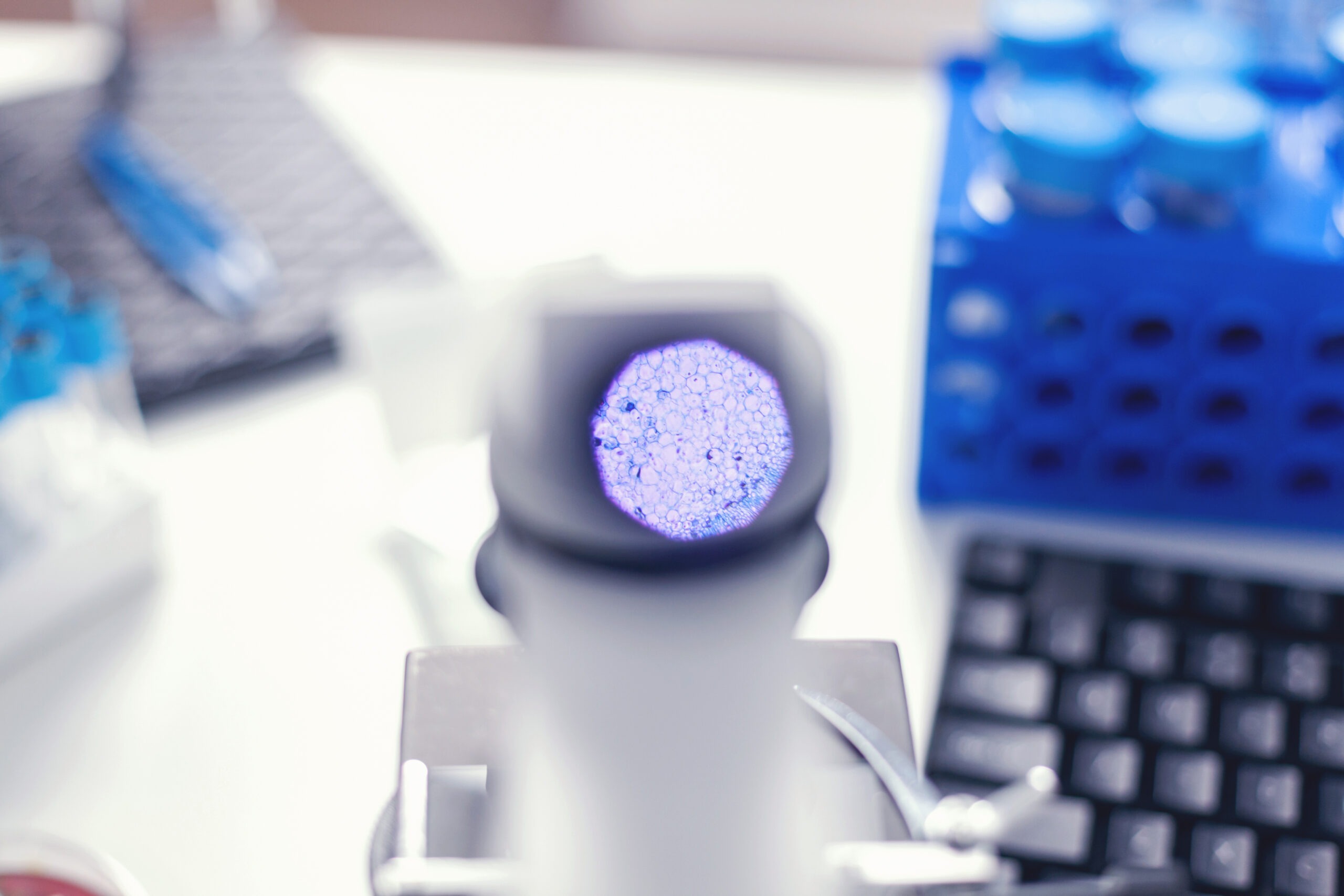 Local Recurrence and Survival in Patients With Melanoma In Situ