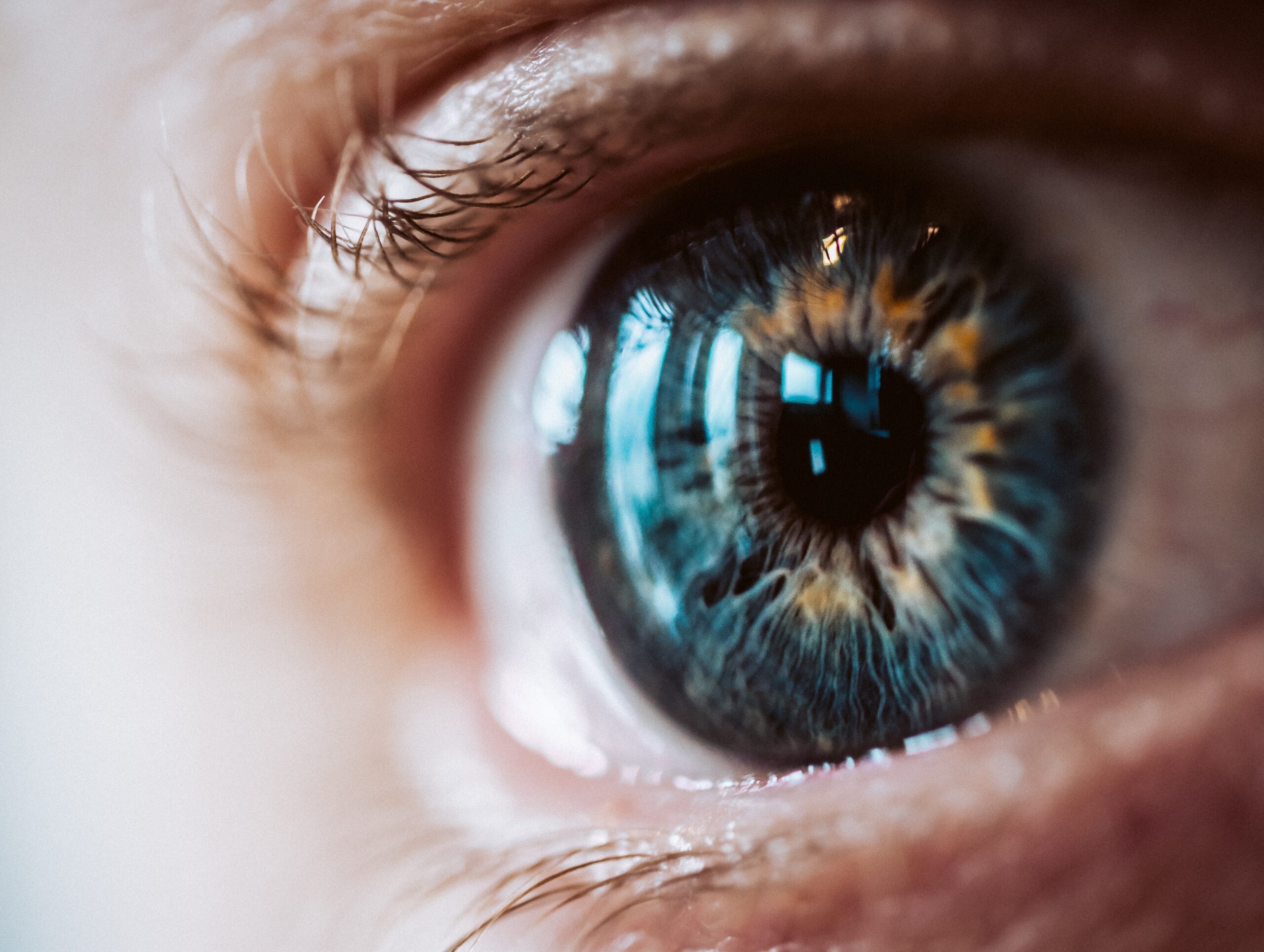 All Eyes on Dermoscopy: Features of Benign Conjunctival Melanocytic Lesions