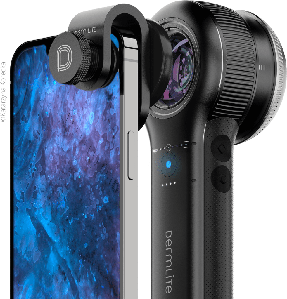 DL5 dermatoscope