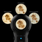 منظار الجلد DermLite مع صور مستقطبة متقاطعة ومتوازية