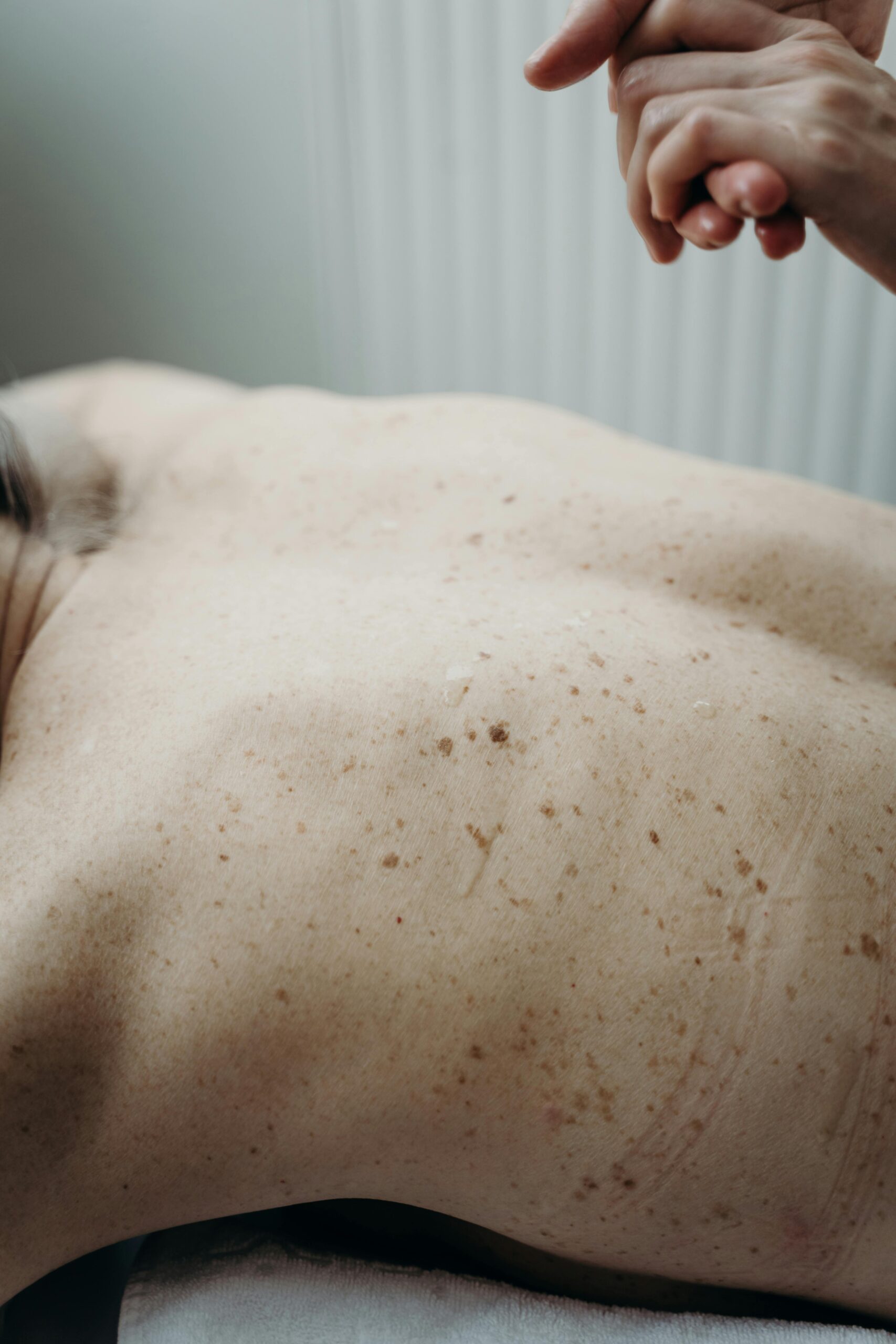 Rethinking Melanocytic Tumors: A Critical Appraisal of the WHO Classification and the Myth of Nevus-to-Melanoma Progression