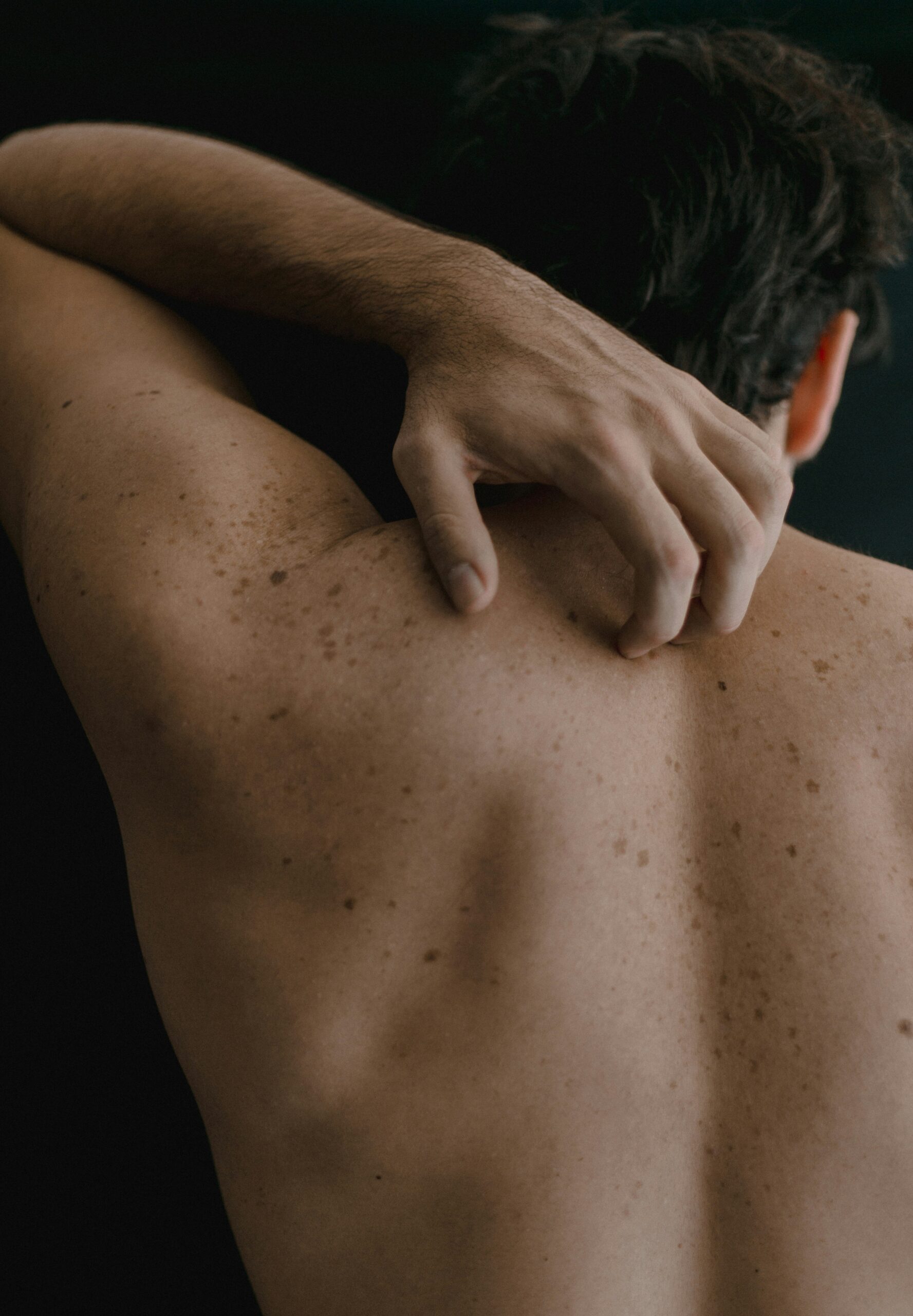 Skin Cancer Risk Profile of Asymptomatic Patients Seeking Periodic Skin Examinations for Skin Cancer Concerns