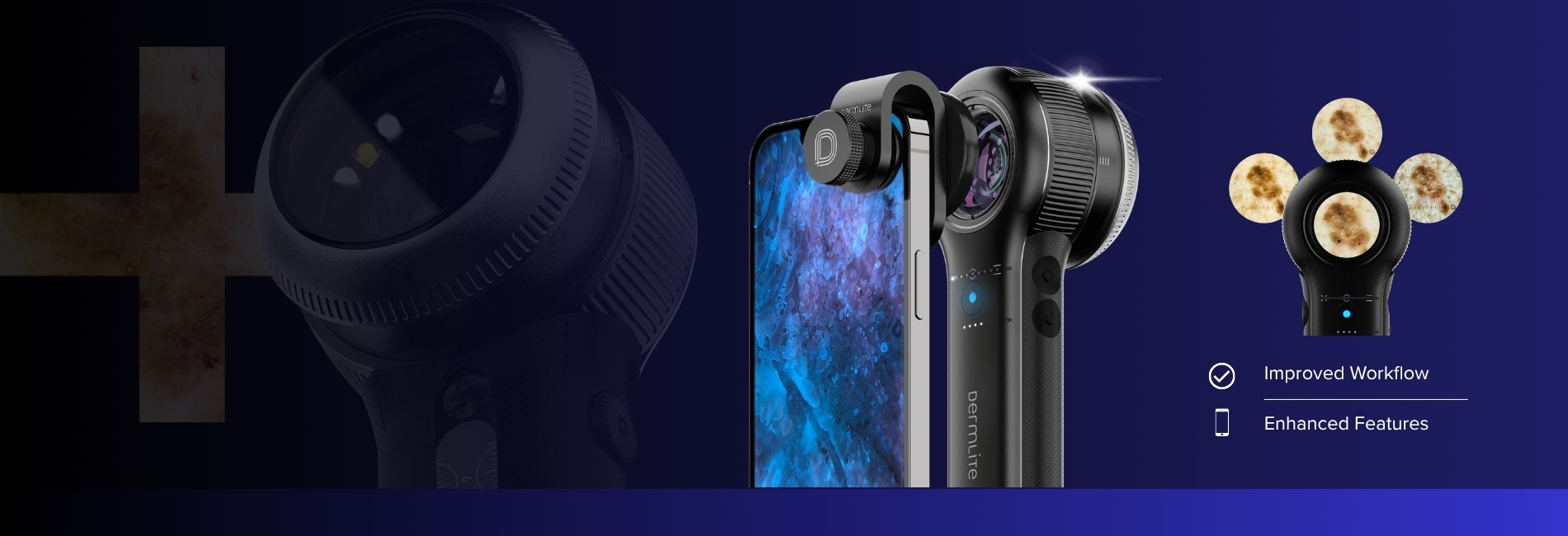 Dermlite DL-5 Plus coming soon.