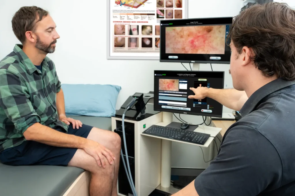 Skin Cancer Detection Devices